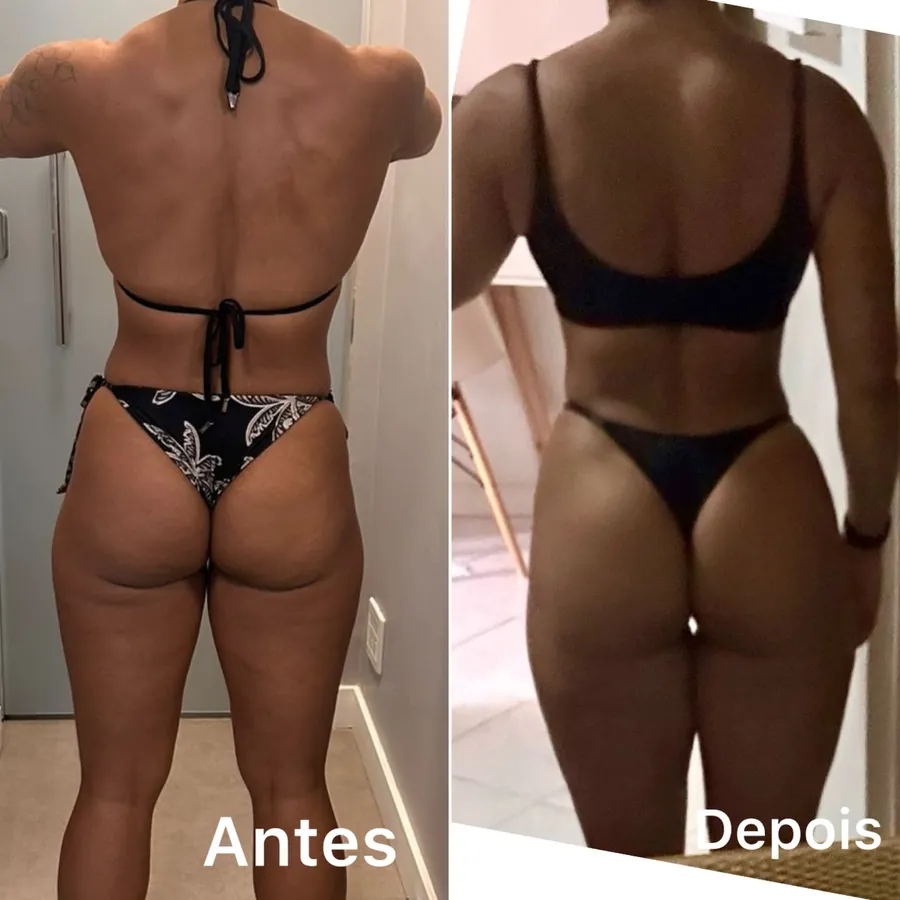 Evolução real 01, antes e depois